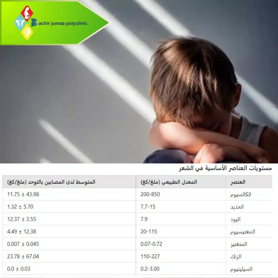 مستويات المعادن في الشعر 