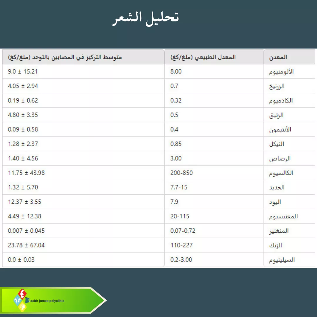 تحليل الشعر